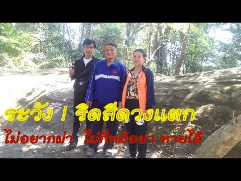 คุณสามารถติดเชื้อโรคสะเก็ดเงิน การป้องกันการหยุดกลาก