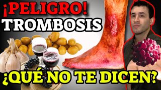 TROMBOSIS VENOSA: SIGNOS DE ALARMA| LOS MEJORES CONSEJOS PARA PREVENIR LA TROMBOSIS