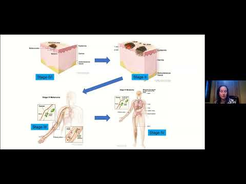 Ask the Expert - What Do I Do Next: A Roadmap for Care After an Early Stage Melanoma Diagnosis