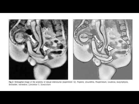 Improbable Research Collection #119: MRI Sex