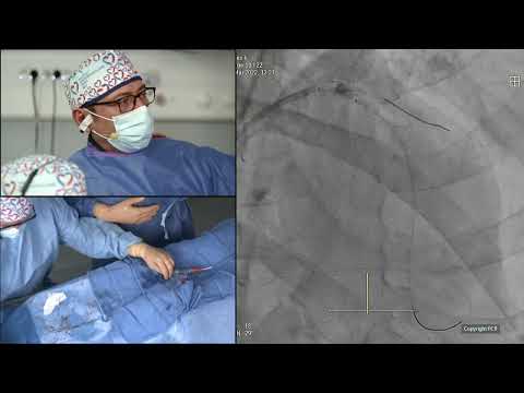 Left main and complex bifurcation PCI in high bleeding risk patients - EuroPCR 2022