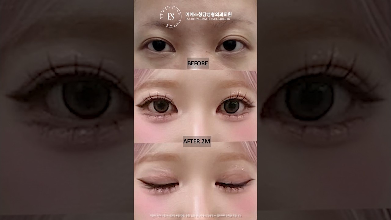 이에스 유튜브