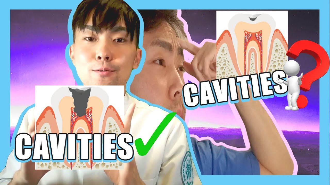 How Do Cavities look Like?