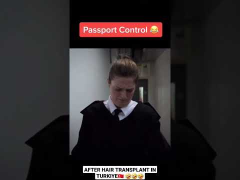 Passport Control After Hair Transplantation 😂 #shorts