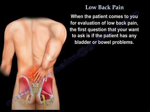 Low Back Pain: Causes, Diagnosis, Imaging, and Treatment Options