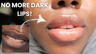 How to Get Soft, Even-Toned Lips – Expert Secrets Revealed!