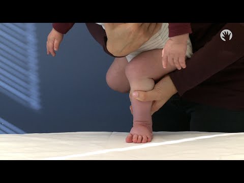 Clubfoot Stretches | Standing Out of the Braces | Module 3