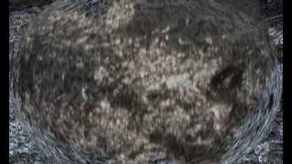 XTC (Andy Partridge) - Pearl (1980)