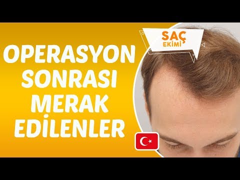 Saç Ekimi Operasyonu Sonrası Dikkat Edilmesi Gerekenler Nelerdir? - Dr. Hamid AYDIN