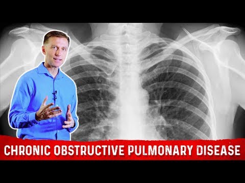 How to Overcome Adrenal Stress with Intermittent Fasting – Dr Berg