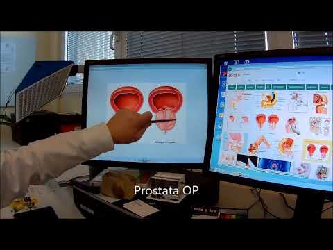 Prostatakrebs Chirurgie und ihre Komplikationen Wege zu verhindern Prostatitis