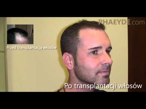 Oleje Estelle do włosów Można rosną włosy na rolce