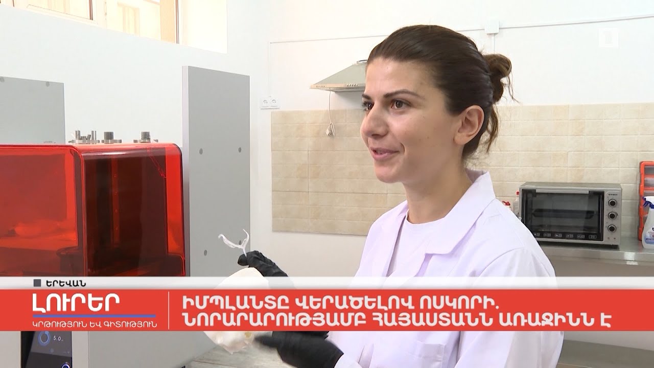 Իմպլանտը վերածելով ոսկորի․ նորարարությամբ Հայաստանն առաջինն է