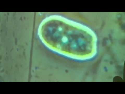 Parassiti in vermi di pesce Se gli insetti sono parassiti