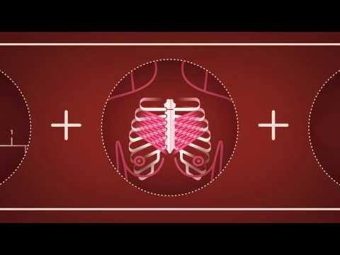 Beyond The Shock - Chapter 5 -  Types & Stages - Stage 3 Breast Cancer