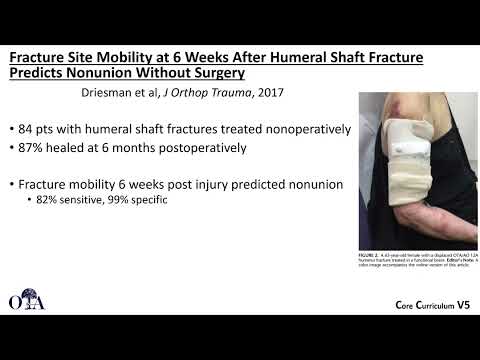 Humeral shaft fractures - 3 of 4