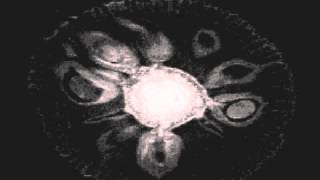 Maeror Tri - A1/ Ambrosia