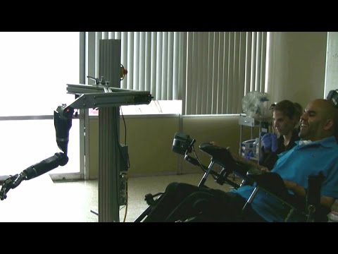 New tech helps quadriplegic control robotic arm with mind