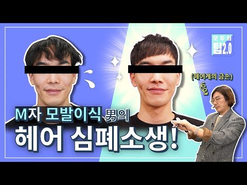 M자 모발이식男의 헤어 심폐소생!
