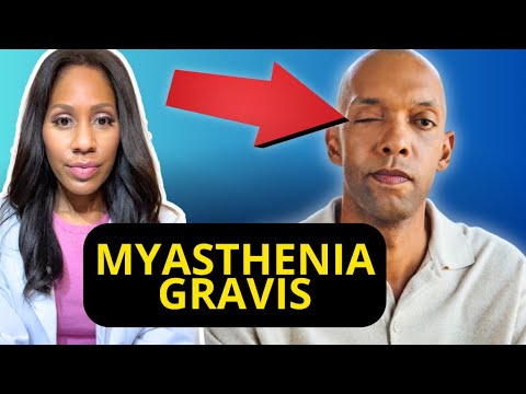 MYASTHENIA GRAVIS: A Doctor Explains Symptoms, Diagnosis & Treatment! 