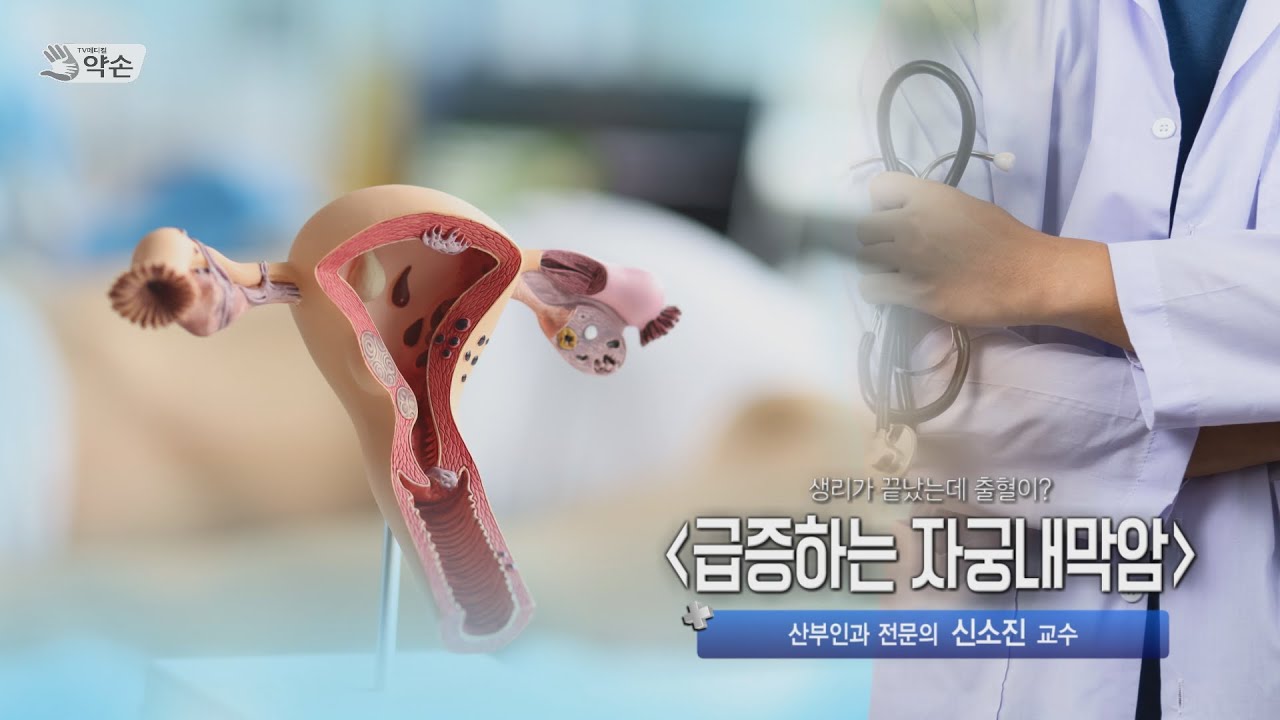 [TV메디컬 약손]20240130(716회) 생리가 끝났는데 출혈이? '급증하는 자궁내막암'_계명대학교동산병원 신소진 교수 / 산부인과 전문의 관련사진