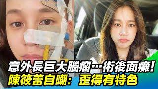 勇敢最美／女星長巨大腦瘤…術後面癱　陳筱蕾近況曝光