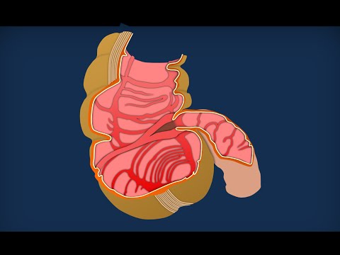 Medicine contro helminths a vacche Parassiti ipodermici ai sintomi di persona e il trattamento