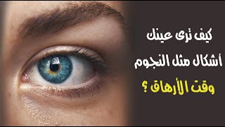 كيف ترى عينك اشكال مثل النجوم وقت الأرهاق ؟