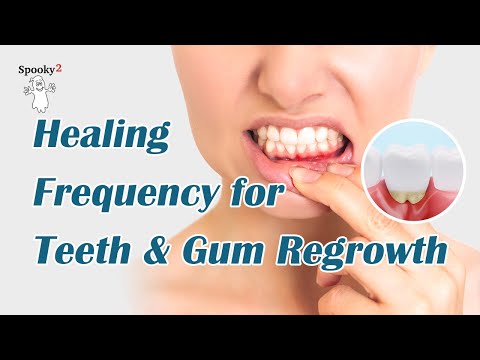 Gum Healing + Tooth Repair | Powerful Rife Frequencies | Teeth Healing Frequencies | 528Hz + 432Hz