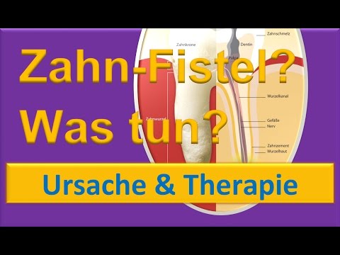 Ton und Salz für Gelenke Bursitis des Kniegelenks Foto