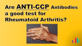 Download lagu Are anti CCP Antibodies a Good Test for Rheumatoid Arthritis? mp3 Download lagu Are anti CCP Antibodies a Good Test for Rheumatoid Arthritis? mp3