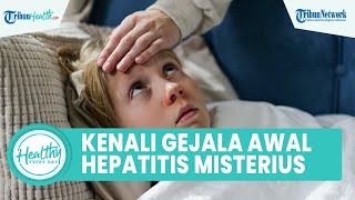Banyak Tak Menyadari Gejala Hepatitis Akut Misterius Dapat Picu Kematian, Kenali dari Sekarang!