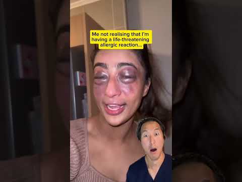 When You Get A Major Allergic Reaction and Don’t Know What To Do…