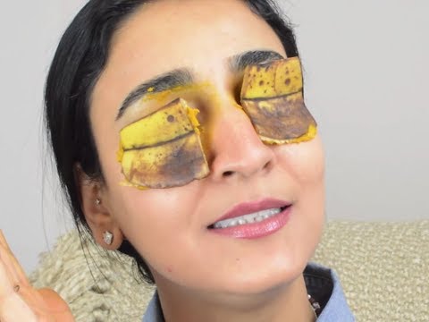 Use this MAGIC home remedy to get rid of dark circles fast!