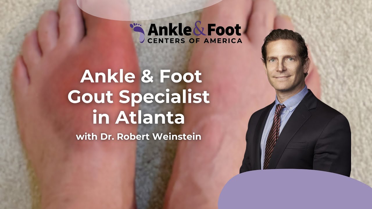 Ankle & Foot Gout Specialist in Atlanta | Ankle & Foot Centers of America