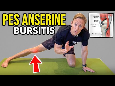 Pes Anserine Bursitis - Knee Rehab Exercises