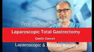 Miniaturka - Total Gastrectomy. Roux-en Y anastomosis. Metin Ertem MD.FACS