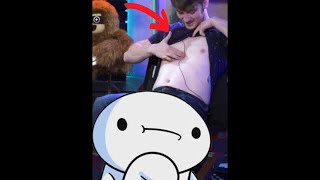 TheOdd1sOut reveals he has a literal hole in his chest video