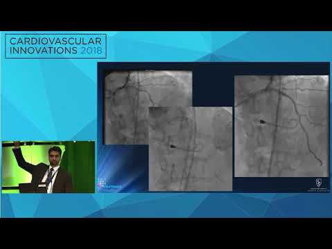 CVI2018 Session: Innovation in managing severe calcification - Perwaiz Meraj, MD