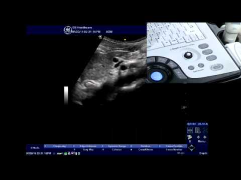 NextGen LOGIQ e: Store Individual Images to Jump Drive