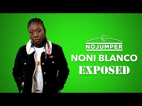 Noni Blanco Exposed!