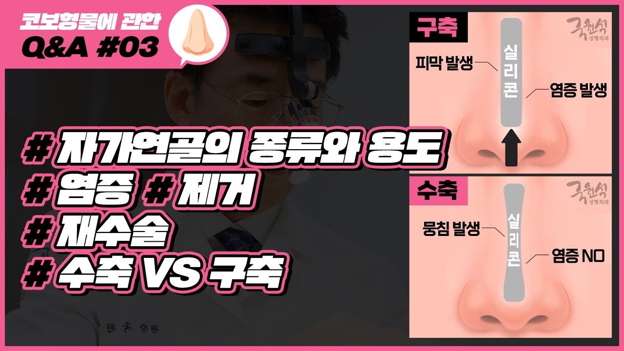 실리콘 보형물에 관한 Q&A #03｜#자가연골 #코보형물염증 #코보형물제거 #코재수술 #수축 등｜코성형 부작용 썸네일
