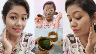 In 15 Days Remove Pimple/Acne | Get Spotless Clear Skin || Krrish Sarkar