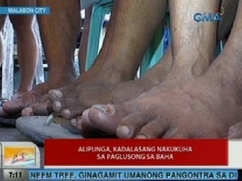 Inflamed ingrown toenail paggamot Ay iodine ay maaaring gamutin ang halamang-singaw paa