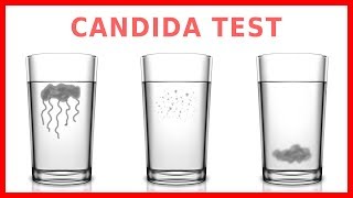 Do You Have Candida? Take The "Spit Test"!