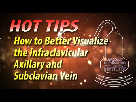 How to Better Visualize the Infraclavicular Axillary and Subclavian Vein