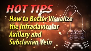 How to Better Visualize the Infraclavicular Axillary and Subclavian Vein