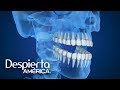 Causas más comunes del dolor de mandíbula Causas más comunes del dolor de mandíbula