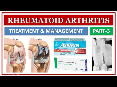 Tratamentul artrozei ce pastile