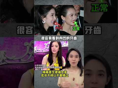 牙齒內傾面相